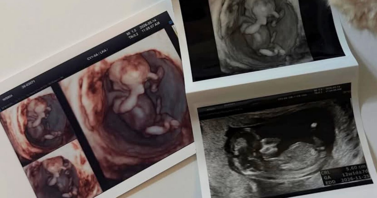 موسيقي ناشط في الـ21 من عمره يُعلن عن حمل صديقته قبل الزواج