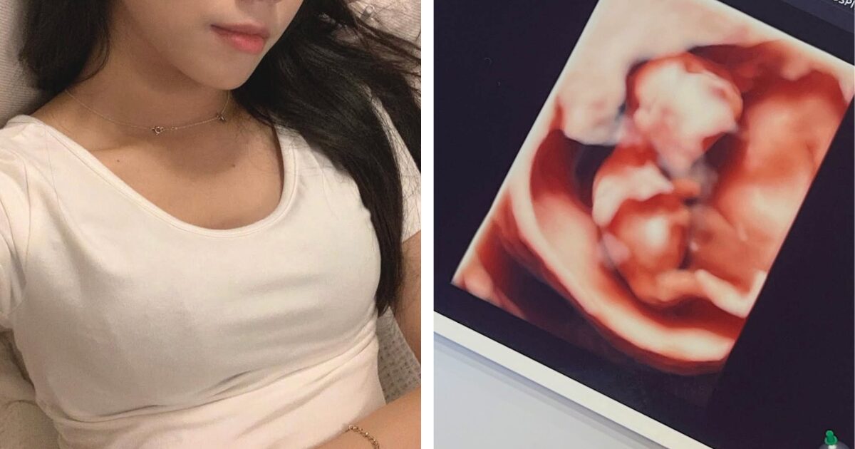 نجمة الجيل الثالث كيم سو-إيون من فرقة ABRY تعلن حملها وسط ضجة على الإنترنت
