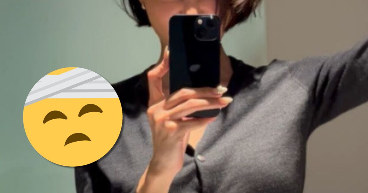 هواسا عضوة MAMAMOO تكشف عن حادث حروق مرعب تعرضت له داخل منزلها
